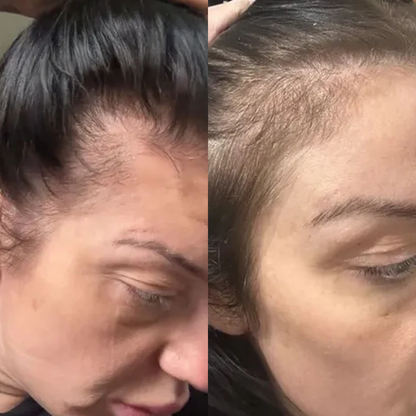 Multi-Collagen 5-in-1 Capsules