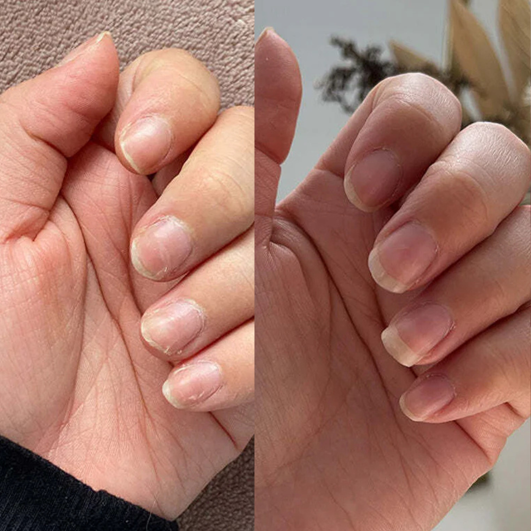 Multi-Collagen 5-in-1 Capsules