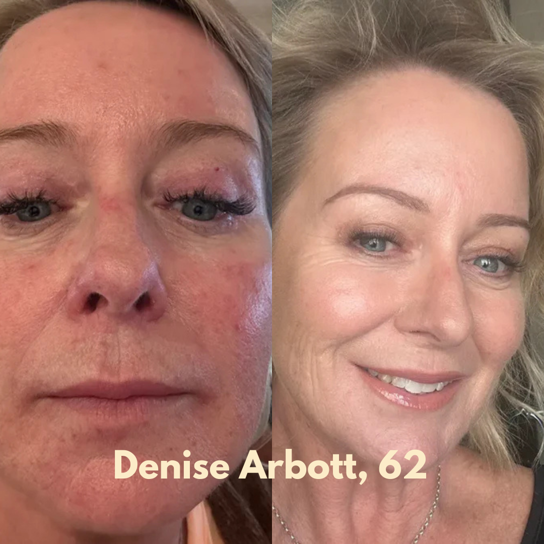 Multi-Collagen 5-in-1 Capsules