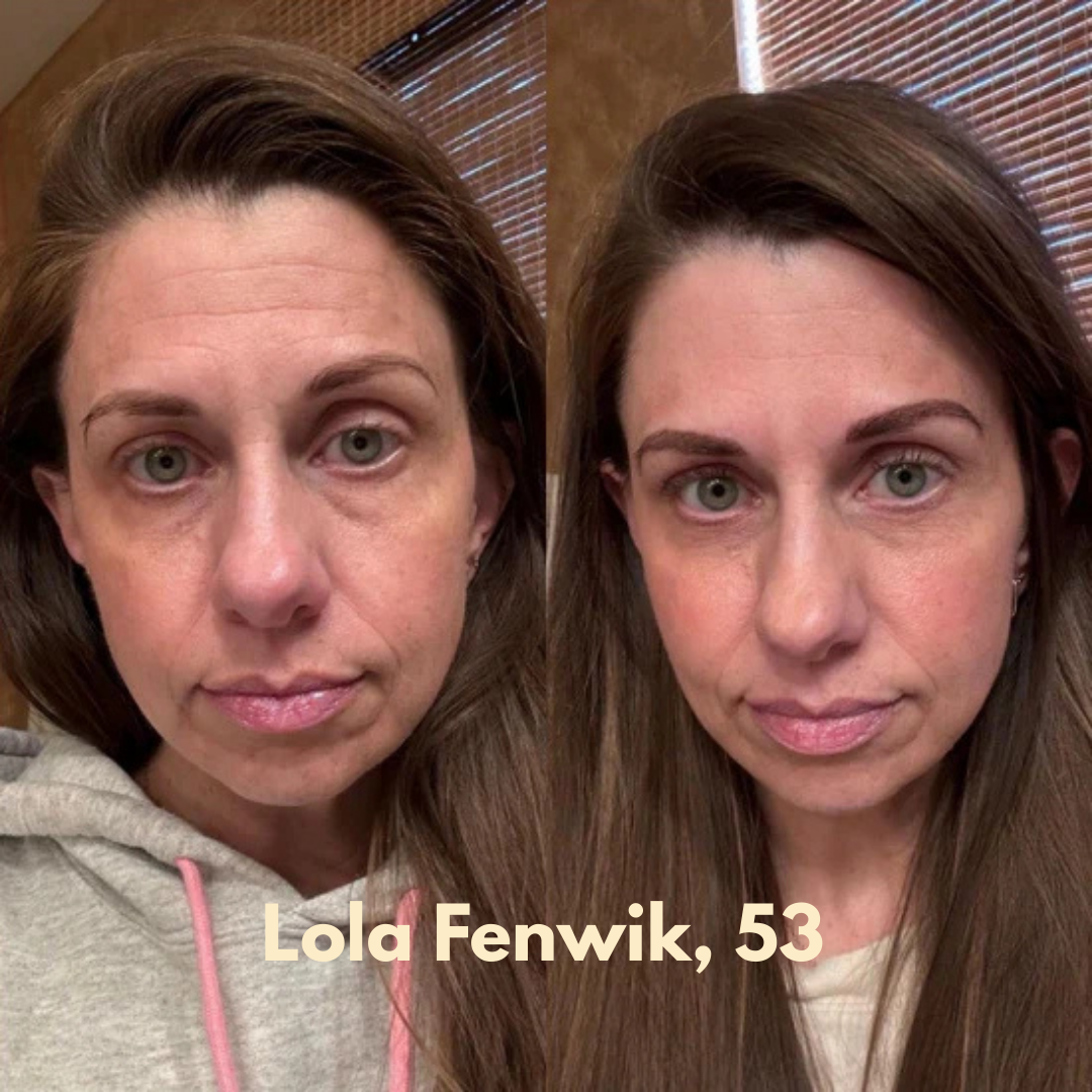 Loofah WillowGlow Bar (Turmeric + Vitamin C + Vitamin B5)