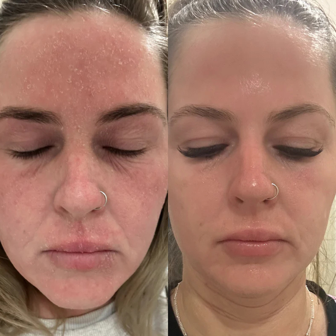 Loofah WillowGlow Bar (Turmeric + Vitamin C + Vitamin B5)