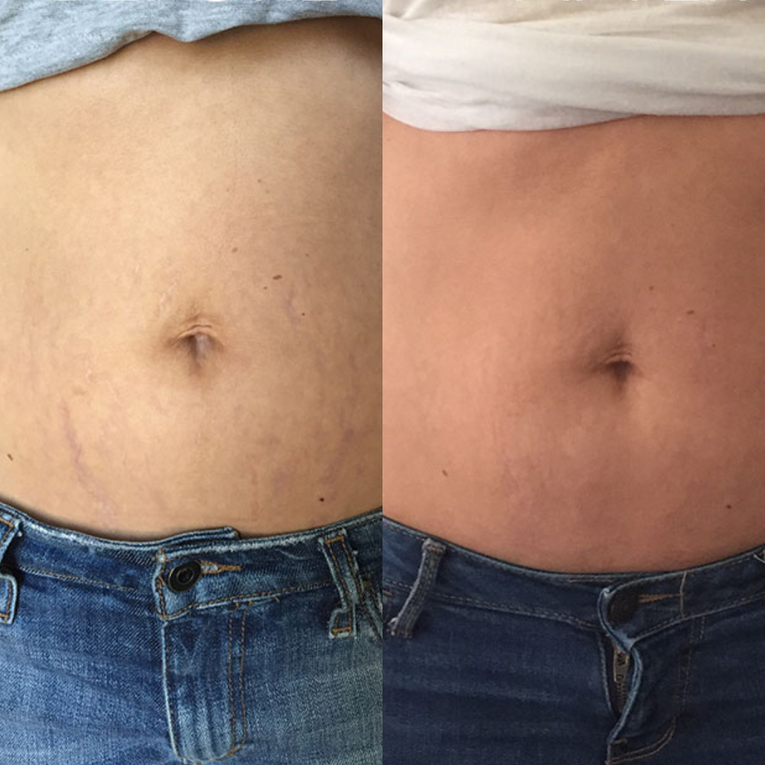 Loofah WillowGlow Bar (Turmeric + Vitamin C + Vitamin B5)