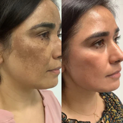 Loofah WillowGlow Bar (Turmeric + Vitamin C + Vitamin B5)