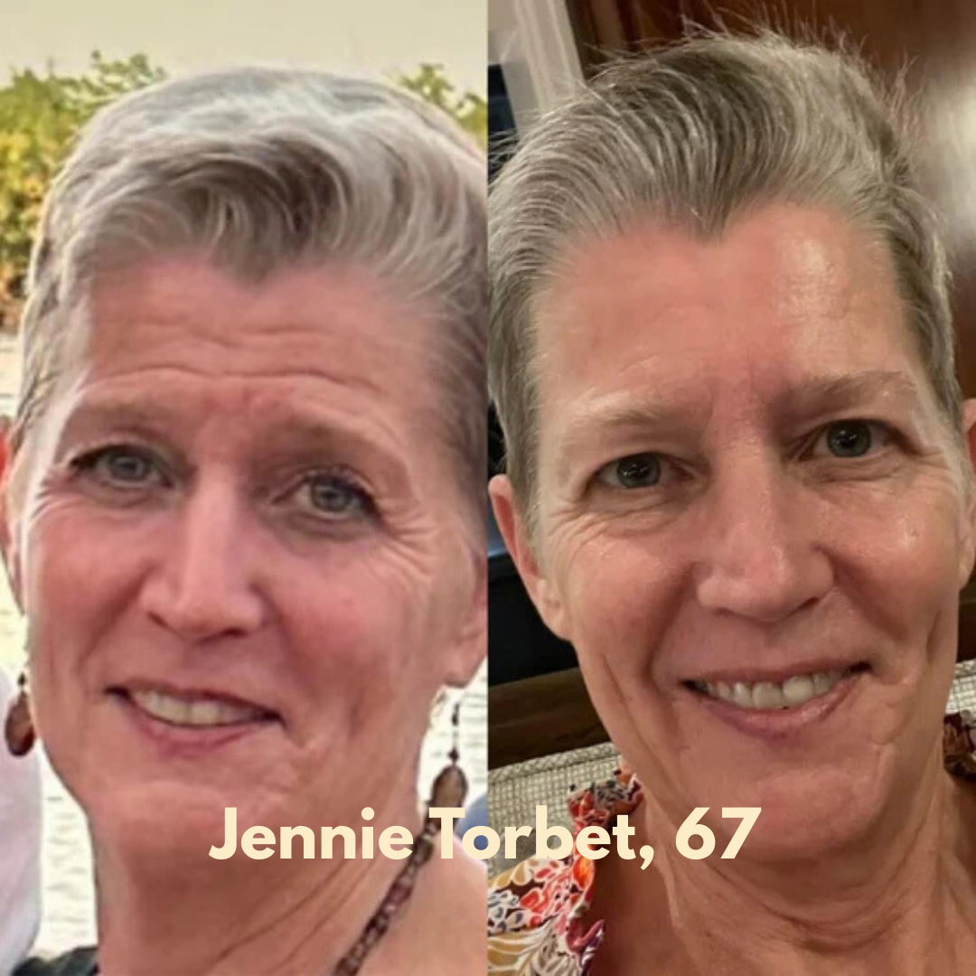 Multi-Collagen 5-in-1 Capsules