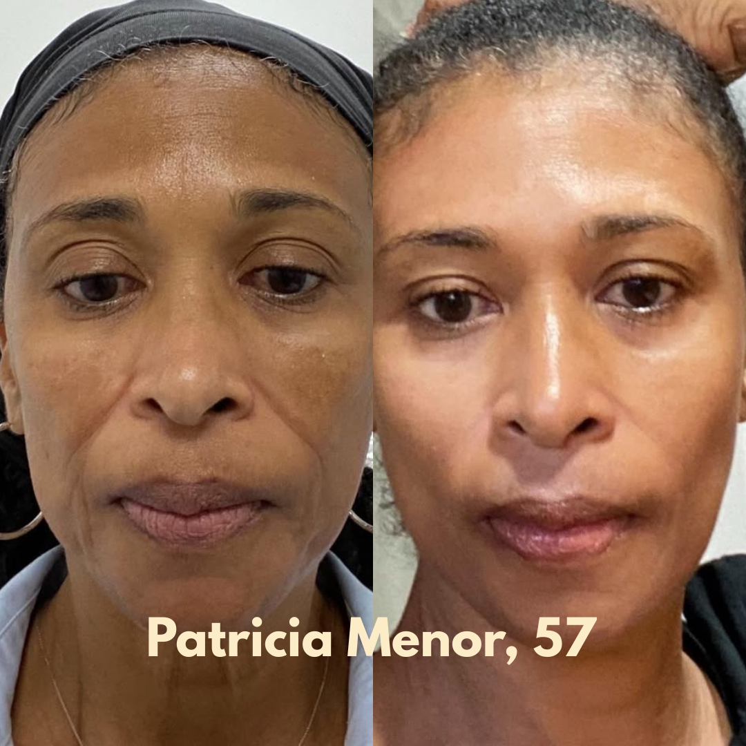 Multi-Collagen 5-in-1 Capsules