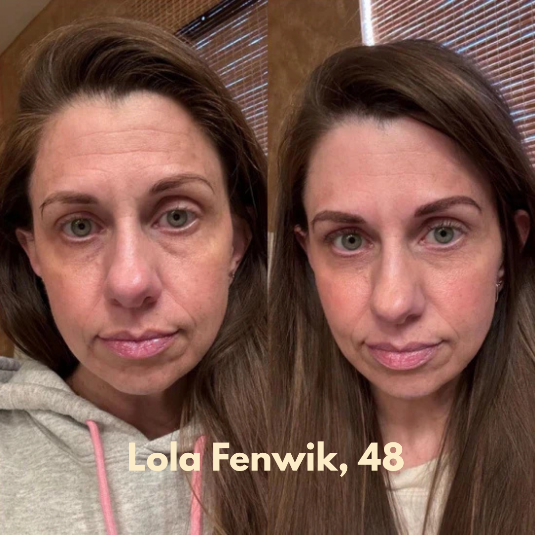 Multi-Collagen 5-in-1 Capsules