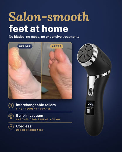 Regal Willow™ Underfoot PRO