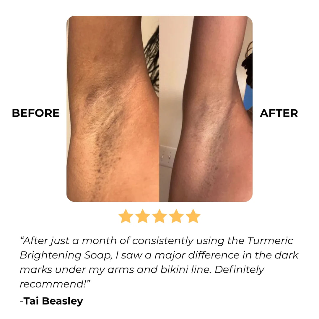 Loofah WillowGlow Bar (Turmeric + Vitamin C + Vitamin B5)