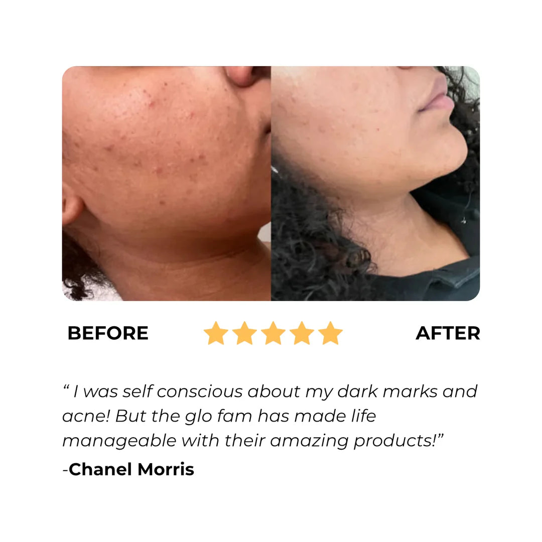 Loofah WillowGlow Bar (Turmeric + Vitamin C + Vitamin B5)